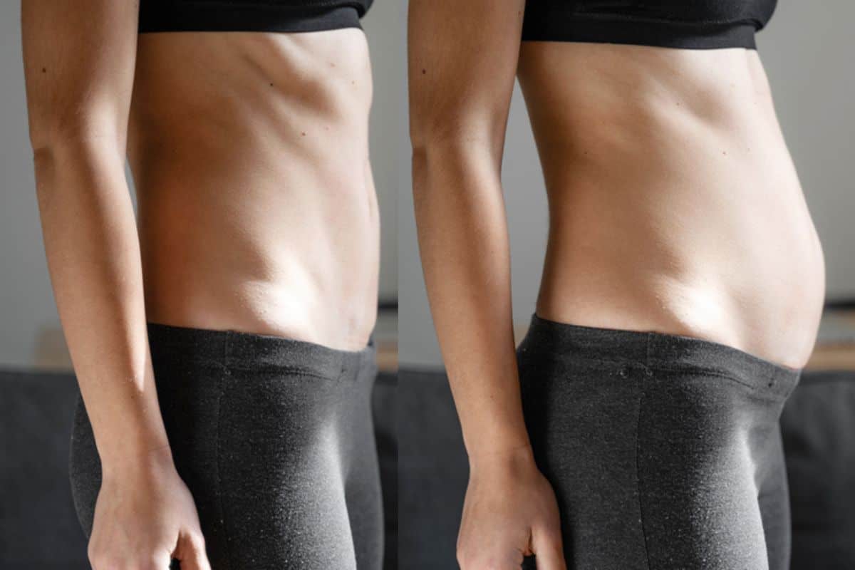 How long does diastasis recti take to improve Higham Hill?
