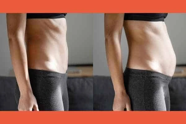 LA-EMS Body Sculpting results Higham Hill