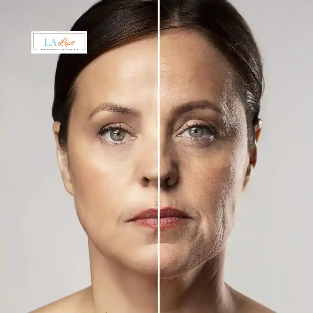 How Can You Tell If Non-Surgical Skin Tightening Is Right for You Higham Hill?